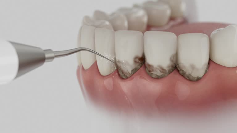 Trusted Teeth Cleaning And Checkup service in Rittman, OH - Dentist Open Now